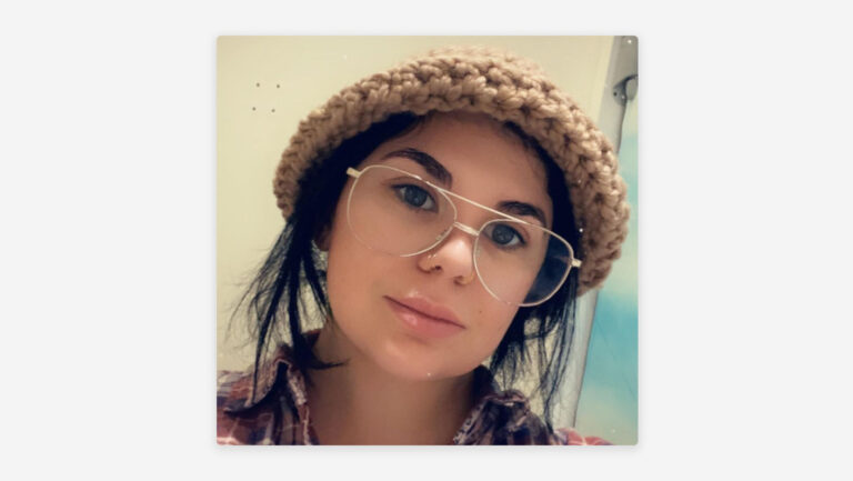 Joven descubre que tiene 5 órganos extra