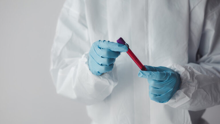 Confirman muerte por fiebre Lassa en EEUU