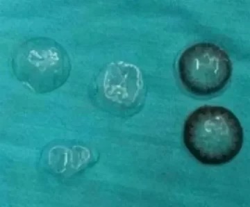 Pierde cinco lentes de contacto adivina ¿dónde los encontraron?