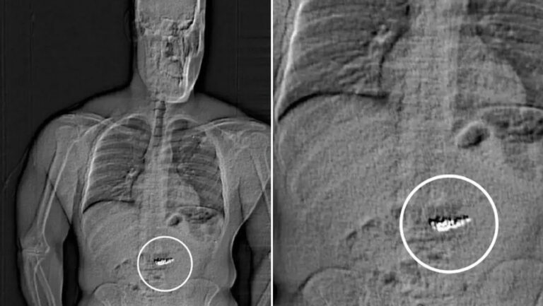 Ladrón se traga diamantes valorados en más de 700 mil dólares