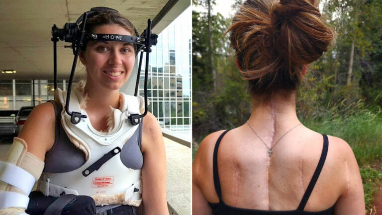 Mujer quedó al borde de la decapitación interna