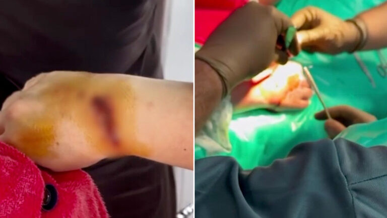 Tiburón nodriza muerde a turista en aguas paradisíacas