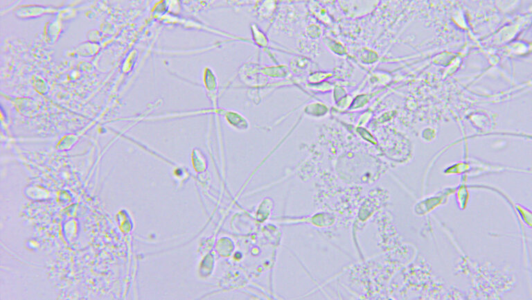 Realizarán la primera carrera de espermatozoides
