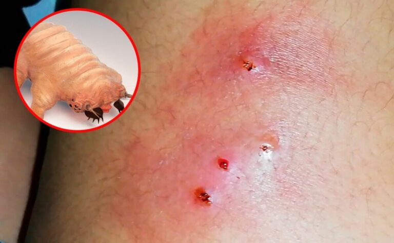 Honduras reporta la muerte de una persona afectada por el gusano barrenador