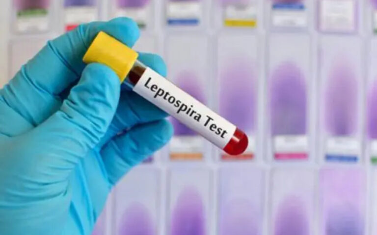 Nicaragua lanza Campaña Nacional contra la Leptospirosis con 400 mil dosis preventivas