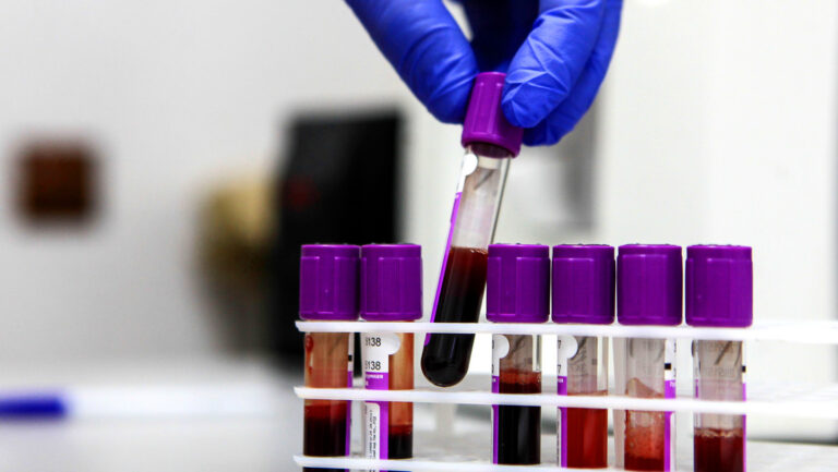 Rusia inicia ensayos de vacuna contra el cáncer