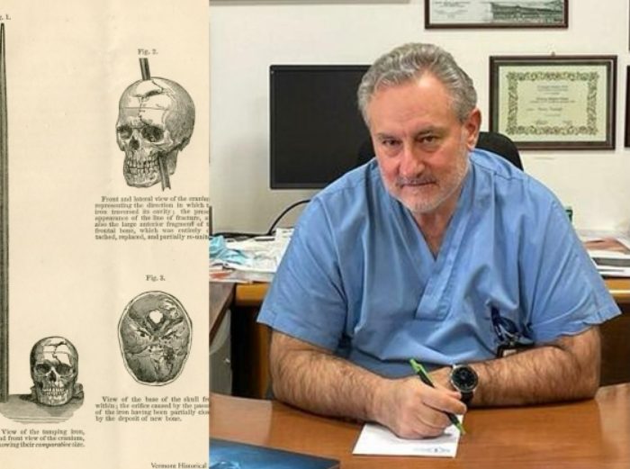 Sobrevive con flecha clavada en su cabeza