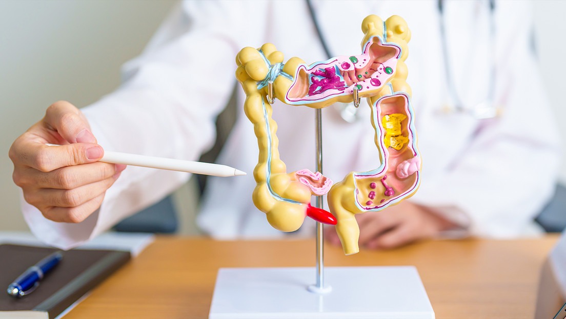 Conoce cuatro hábitos para prevenir el cáncer de colon