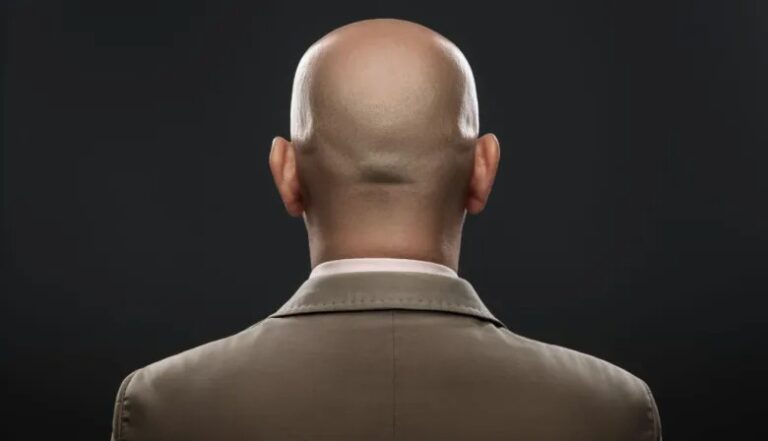 Determinan que llamar a un hombre “calvo”, es acoso sexual