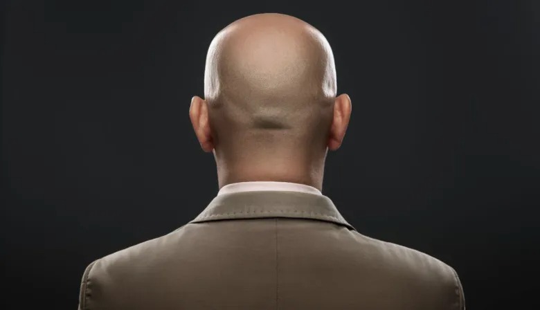 Determinan que llamar a un hombre “calvo”, es acoso sexual