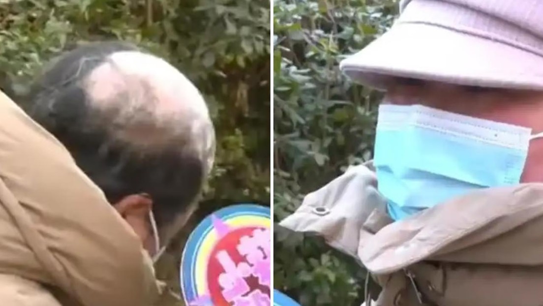 Se divorcia de su esposa por perder el cabello por vitíligo