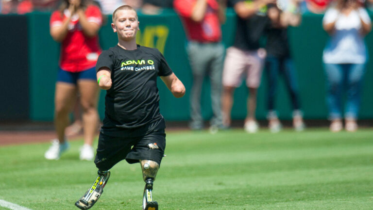 Hombre sin sus cuatro extremidades enfrenta cargos de asesinato