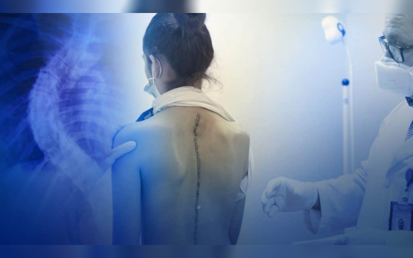 Cirugías de columna en Hospital Dr. Fernando Vélez Paiz