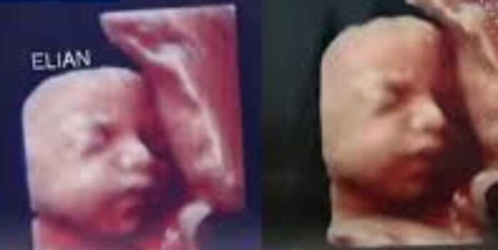 Clínica entregaba la misma ecografía a todas las embarazadas