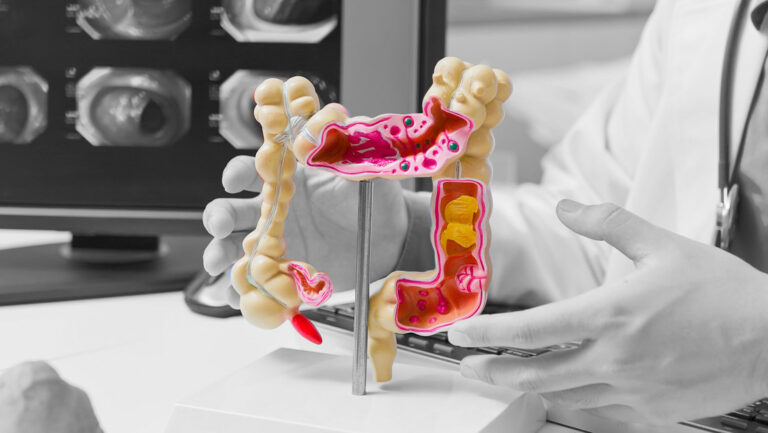 Muerte por cáncer colorrectal está en aumento en EEUU