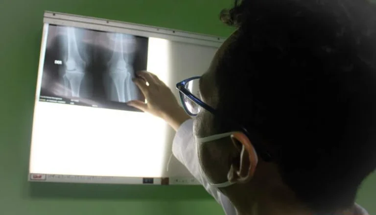 Capacitarán a más de 100 trabajadores de la salud en Simposio de Ortopedia en Managua