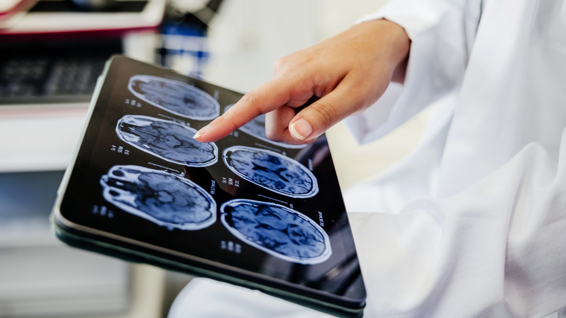 Descubren nuevo método para detectar el Alzheimer en fase temprana