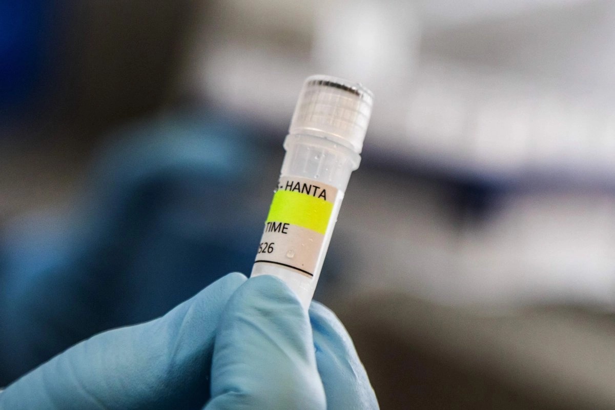 Primer caso de hantavirus en Israel
