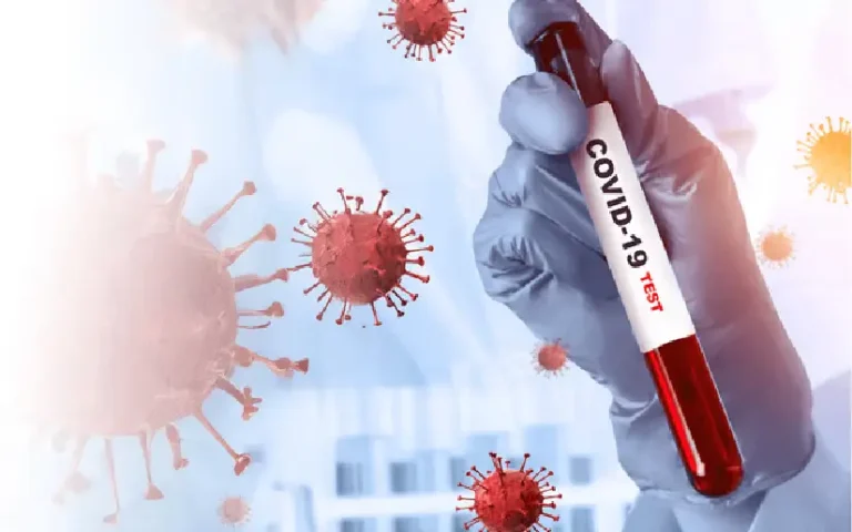 Nicaragua: Situación del Coronavirus al 28 de Julio 2026