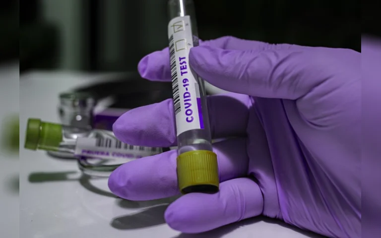 MINSA da a conocer situación del Coronavirus al 07 de julio de 202