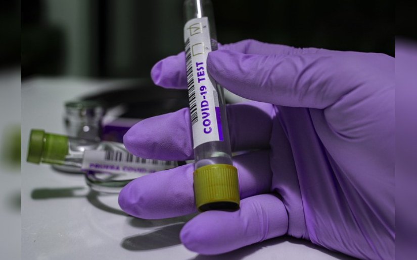 MINSA da a conocer situación del Coronavirus al 07 de julio de 202