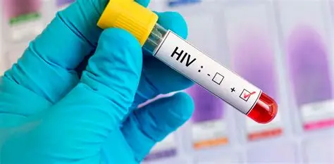 Realizan primeros ensayos de nuevo medicamento contra el VIH