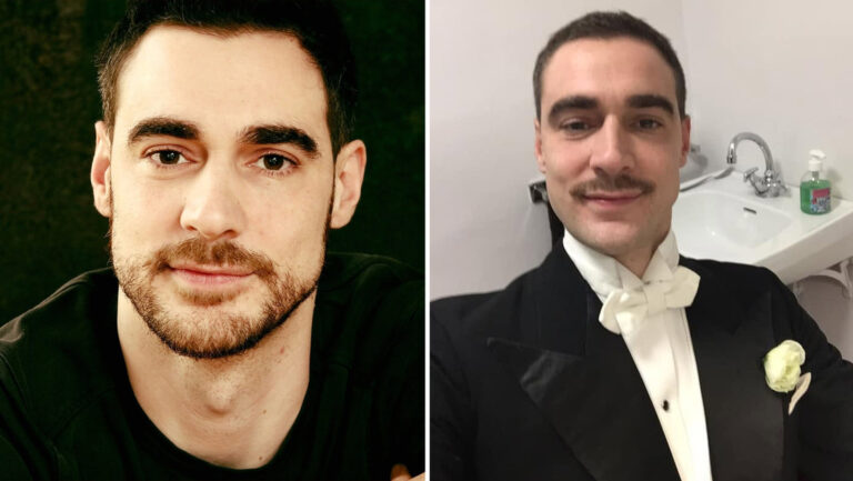 Actor francés recurre a la eutanasia tras meses de dolor por una prótesis
