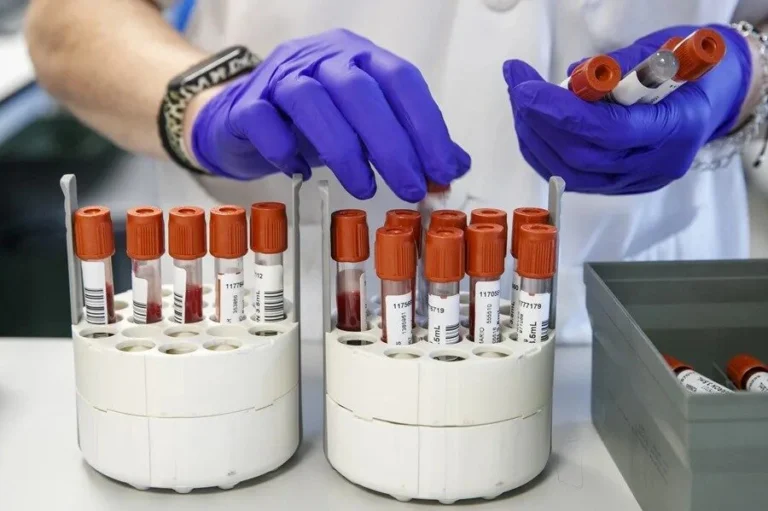 Estados Unidos registra 4.410 casos de sarampión en 2026, la cifra más alta desde 1991