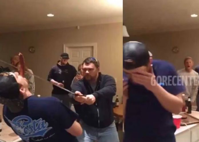 Joven casi pierde la nariz por cumplir un reto de salchic