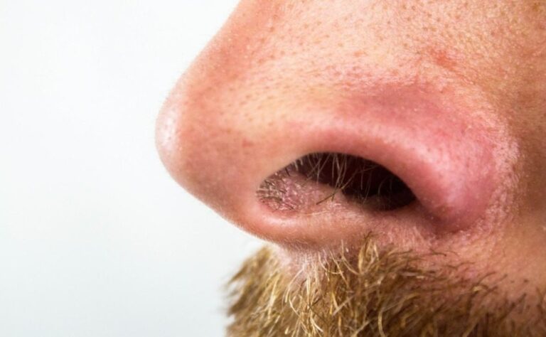 Le arranca la nariz a un cliente creyendo que es el amante de su esposa