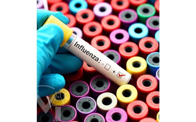 Ministerio de Salud reporta menos contagios de Leptospirosis e Influenza en la última semana