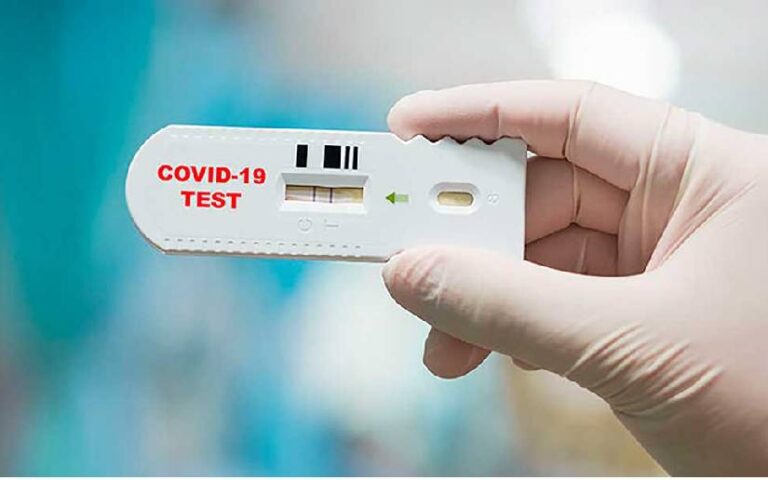 Ministerio de Salud reporta 21 casos de Covid-19 en la última semana