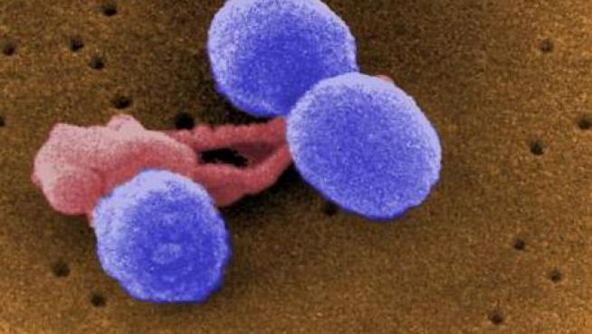 Reportan 4 niños muertos por estreptococo