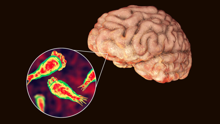 Muere hombre al contraer ameba “comecerebros”