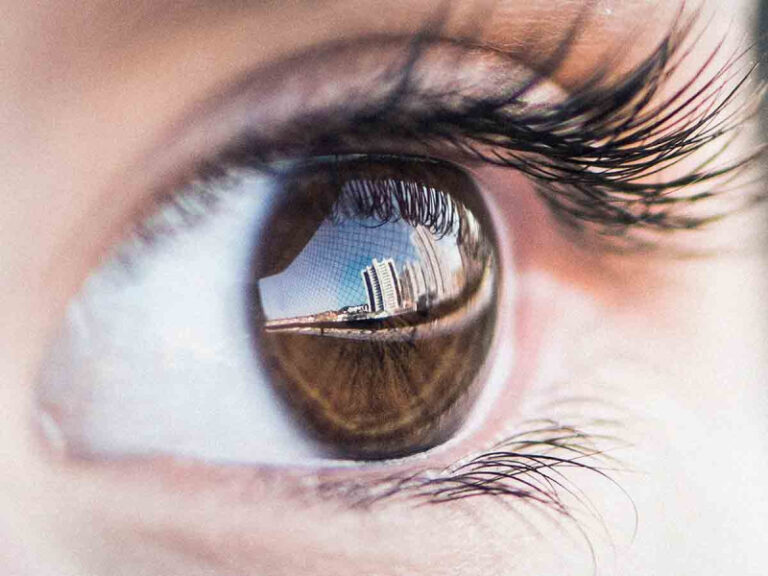 Extraen 60 gusanos vivos de los ojos de una mujer