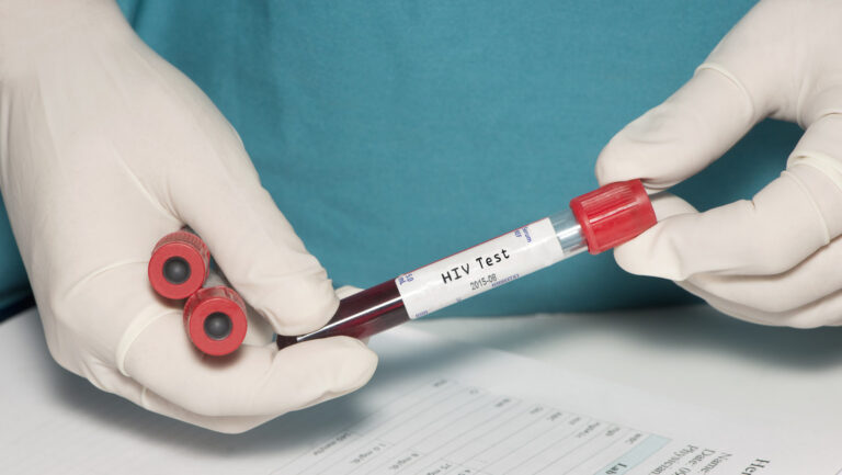 OMS pide reducir número de parejas sexuales para prevenir viruela del mono