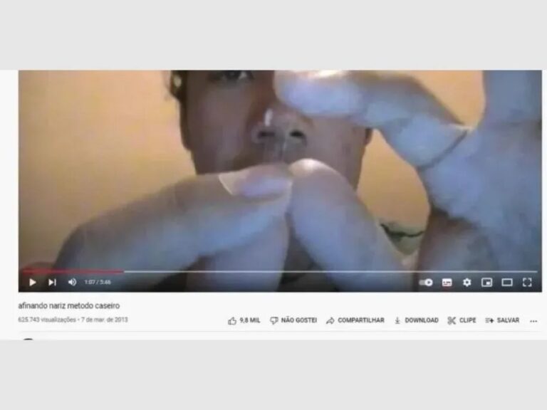 Se opera la nariz él mismo al ver un tutorial por internet