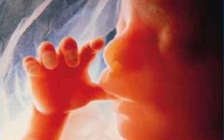 Reconocen modelo de salud de Nicaragua a nivel internacional