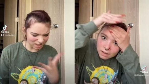 Se corta su rostro al hacer un challenge