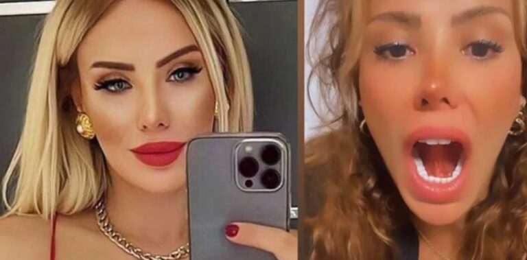 Recibe un beso francés y termina en el hospital