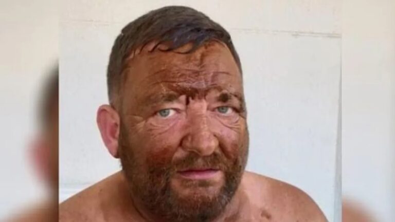 Llegó a broncearse, se durmió, quedo anaranjado y su cita lo bloqueó