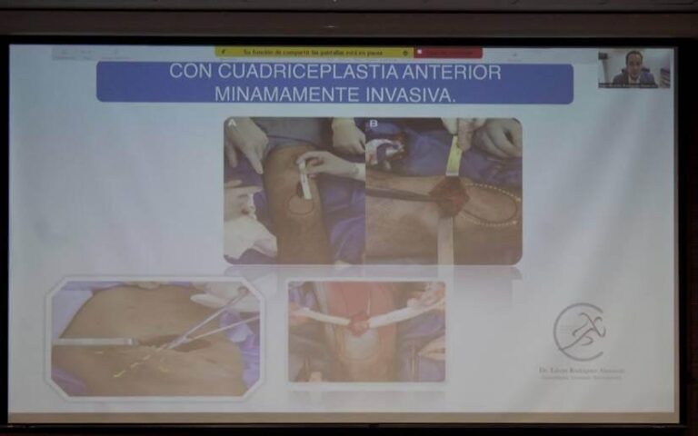 MINSA desarrolla encuentro de Ortopedia y Traumatología