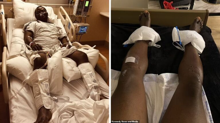 Se realiza dos cirugías para ser más alto y encontrar el amor