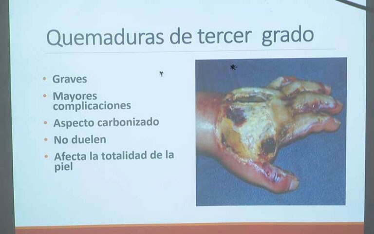 Ministerio de Salud realiza taller de primeros auxilios