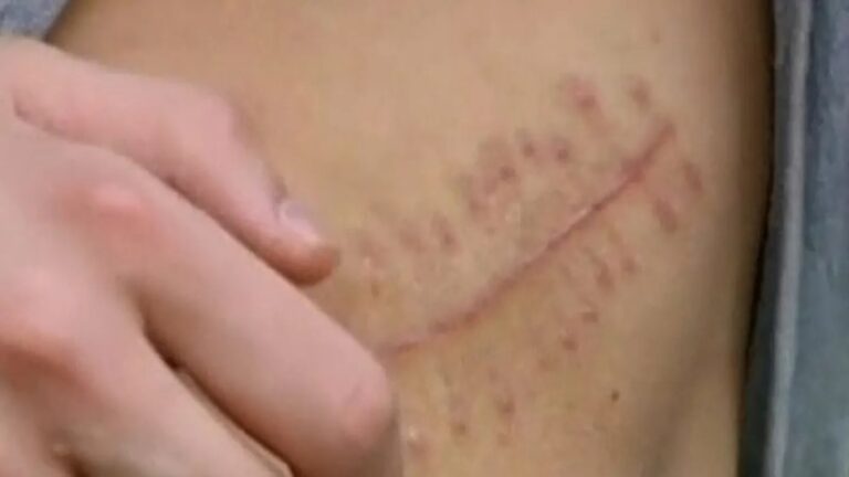 Vende un riñón para comprarse un iPhone y ahora tiene insuficiencia renal