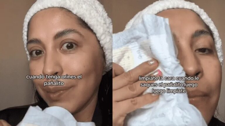 Madre recomienda utilizar pañal orinado para tener una piel impecable