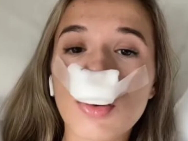 Se opera la nariz para tener hijos “lindos”