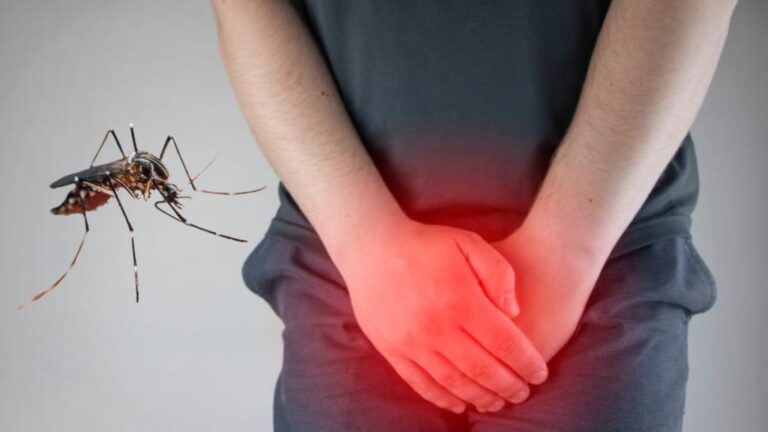 Se enferma de dengue y sufre erección por 18 horas