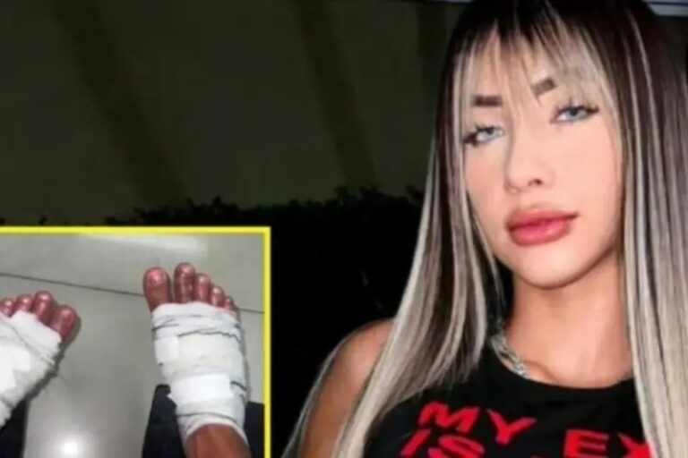 Influencers casi pierde los pies al cumplir un reto