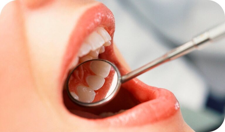 Dentista no la atiende por llevar “restos humanos” en la boca